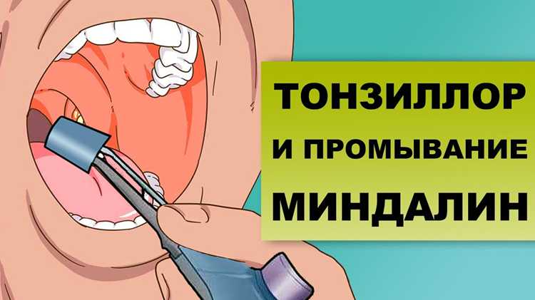 Использование соли и воды для промывания горла