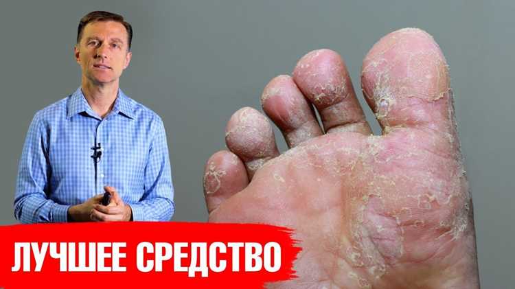 Нарушения кровообращения: как выявить и лечить