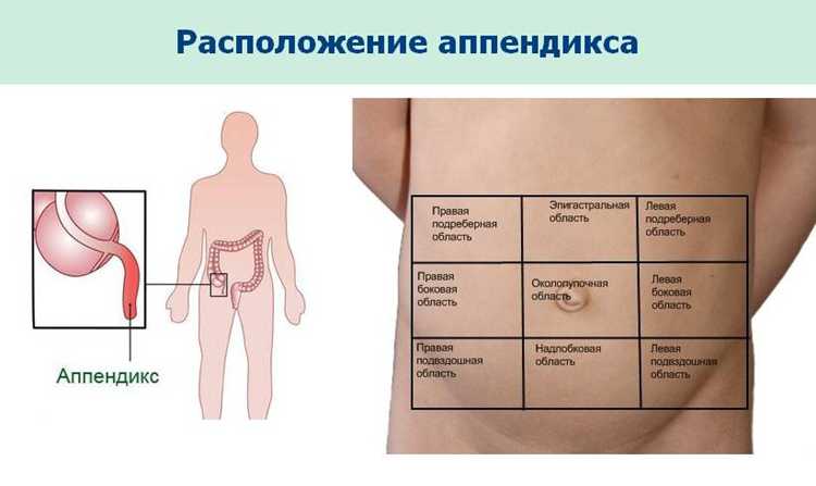 Как отличить боли в животе от аппендицита