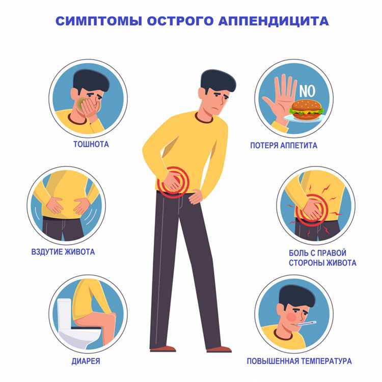 Методы самопроверки на наличие аппендицита