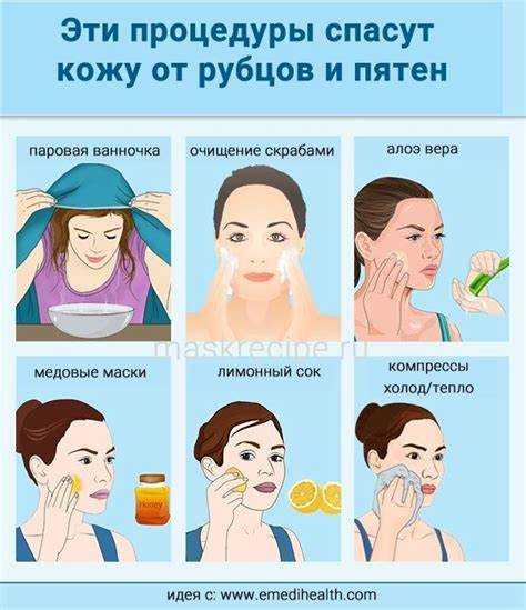 Сода как средство для удаления черных точек