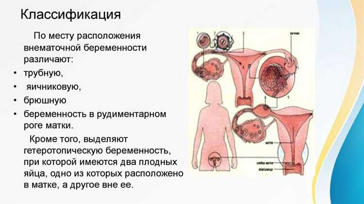 Открытая операция: когда она необходима