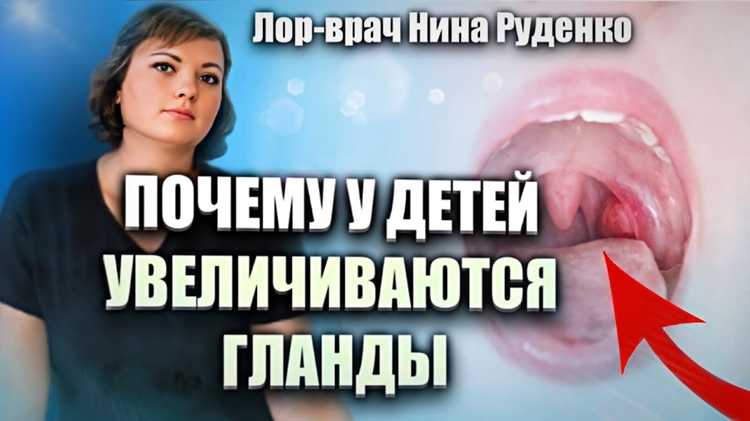 Форма и размер миндалин в норме