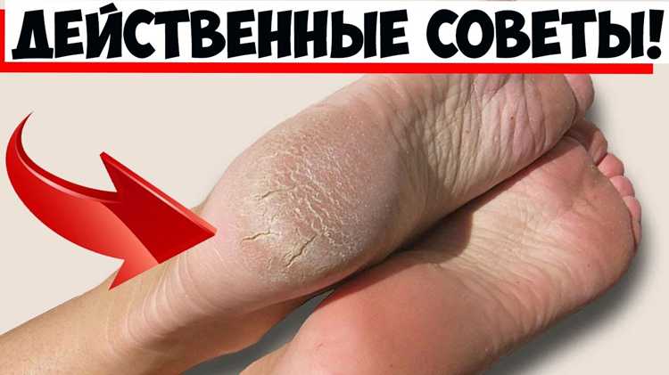 Как правильно увлажнять кожу ног