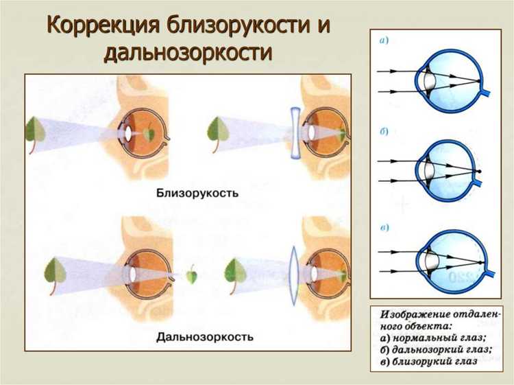 Оптометрические решения: линзы и очки
