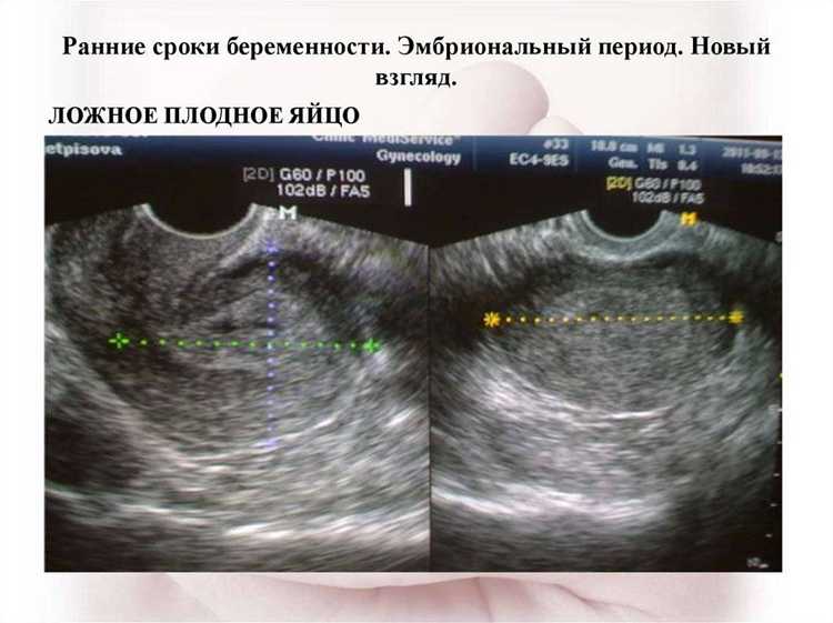 Как следить за развитием плода на 36-й неделе