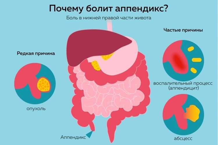 Народные средства для облегчения болей: что выбрать?