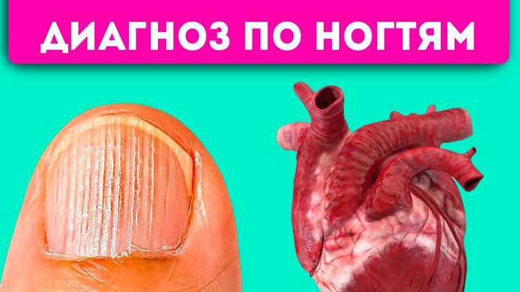 Питание и его влияние на цвет ладоней