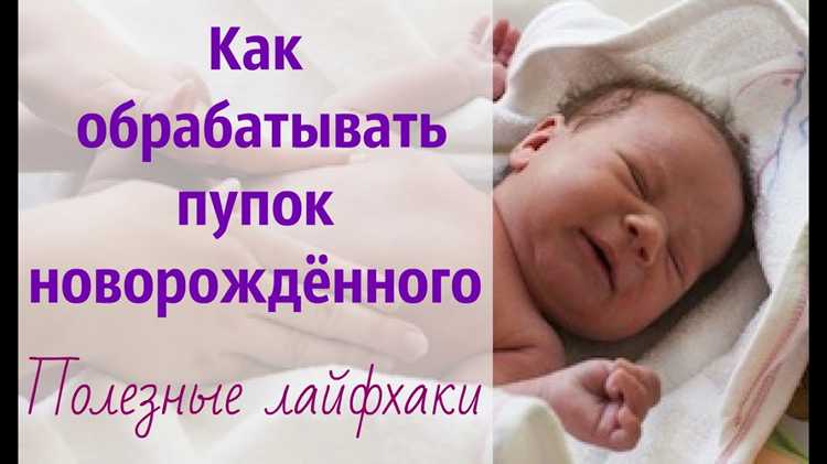 Пупок у новорожденных: особенности и cuidados