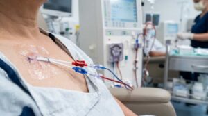 Почему катетер для гемодиализа может перестать обеспечивать нужный кровоток